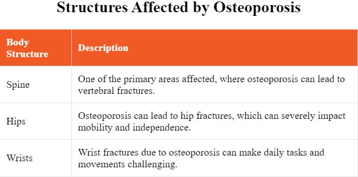 Which structures of the body does osteoporosis commonly affect?
Osteoporosis typically affects areas such as the spine, hips, and wrists.